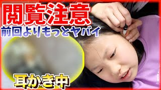 【閲覧注意】耳掃除したら前回よりさらに史上最強の耳垢ゴッソリヤバかったw