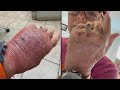 Woman Rushed To Urgent Care After Getting Paper Cut