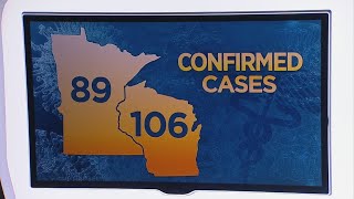 Celebrity Coronavirus In Minnesota: Number Of Positive COVID-19 Cases Climbs To 89 Profile