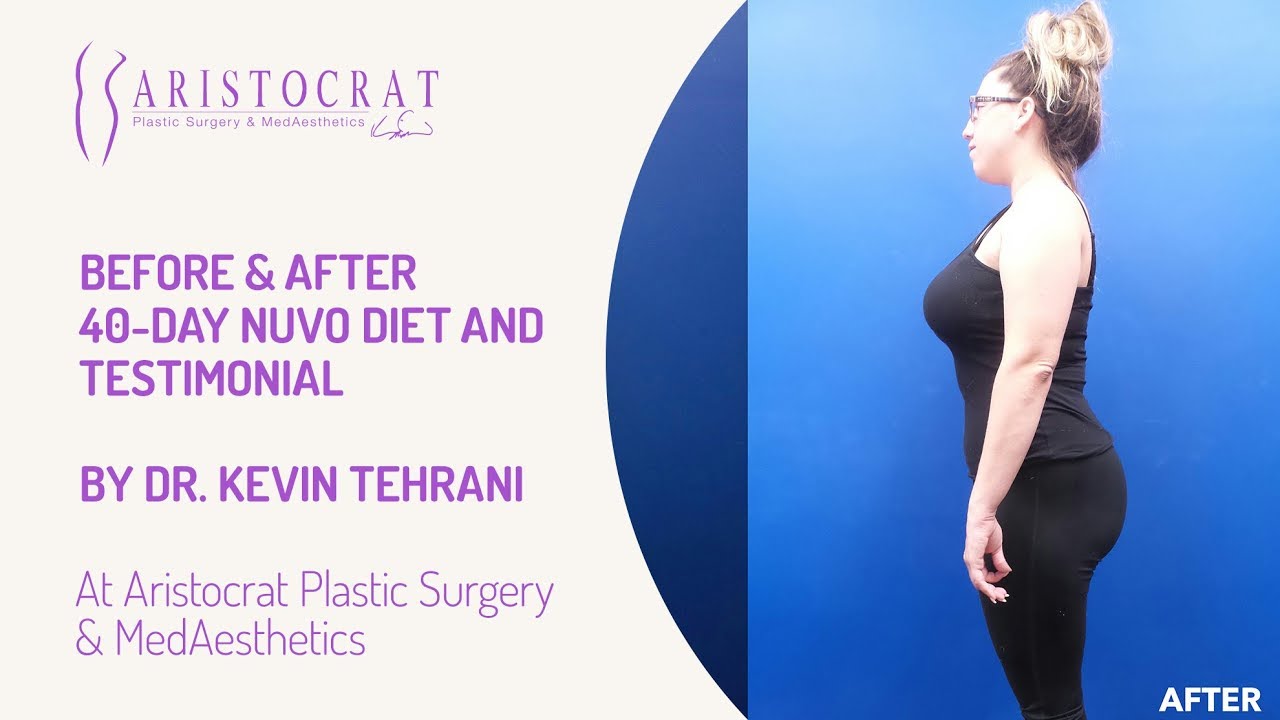 Before & After NUVO Diet Long Island, New York by Dr. Kevin Tehrani ...