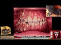 Horror Art Digital Painting Stream - Monday.
