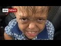 Global support for bullied australian boy bullied schoolboy motivational