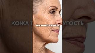 #носогубныескладки #носогубка #татьяналексус #филлер #гиалуроновая_кислота #гиалуроноваякислота