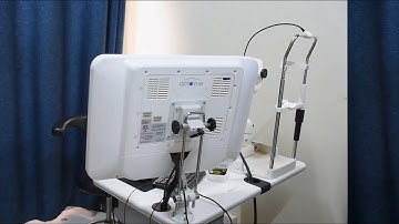 Optovue iVue II OCT: Advanced Eye Imaging Technology