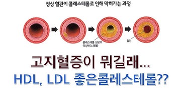 고지혈증(이상지질혈증)이 뭐길래... 왜 이렇게 중요하다고 할까요??? (고지혈증 관리법, 고지혈증약, 고지혈증 영양제, HDL, LDL)