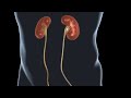 Treatment stent pain that can occur after kidney stone surgery