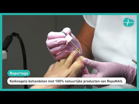 Video: Amorolfin - Instructies Voor Gebruik Voor Nagelschimmel, Vernisprijs, Beoordelingen