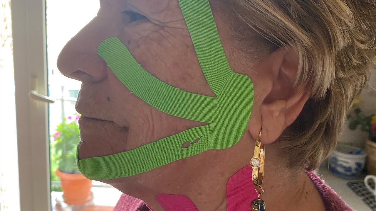 Trattamento viso antiage con coppettazione e Taping elastico YouTube