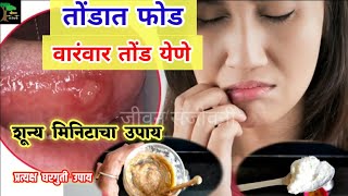 तोंडात फोड , वारंवार तोंड येणे , शून्य मिनिटाचा उपाय ! Tond yene gharguti upay