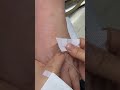 Intramuscular Injection Technique Explained | Safe IM Injection Step-by-Step | Nurse Guide Class 23