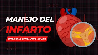 Manejo del Sindrome Coronario Agudo | INFARTO AGUDO AL MIOCARDIO | Guias 2023 | RESUMEN - Harrison