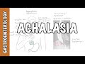 Achalasia (esophageal) - signs and symptoms, pathophysiology, investigations and treatment