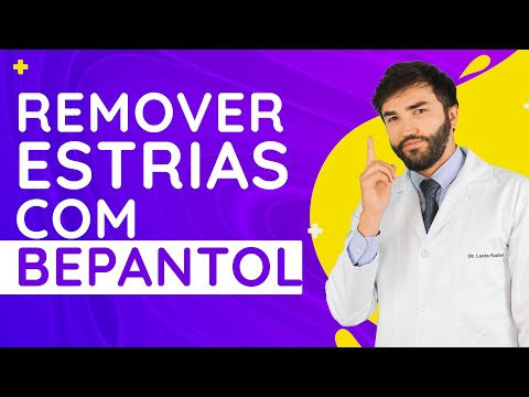 Vídeo: Como Remover Estrias Em Suas Pernas