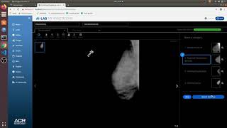 ACR AI-LAB Demo