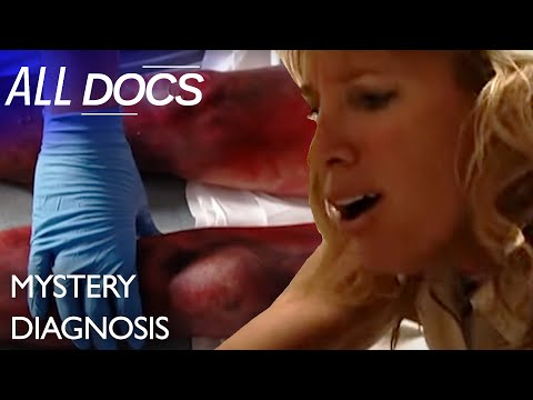 The Woman Whose Legs Turned Black | S08 E06 | Medical Documentary | All Documentary