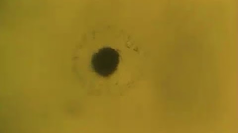 Acoustic vortex