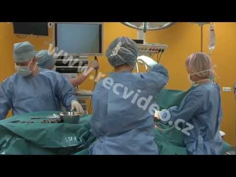 Video: Jaké Jsou Nejbolestivější Operace A Postupy?