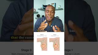 Stages of Cancer Explained