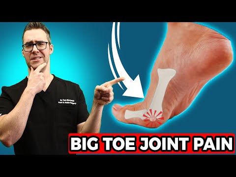 BEST Sesamoiditis Treatment [Big Toe Joint Pain u0026 Big Toe Treatment]