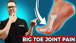 BEST Sesamoiditis Treatment [Big Toe Joint Pain & Big Toe Treatment]