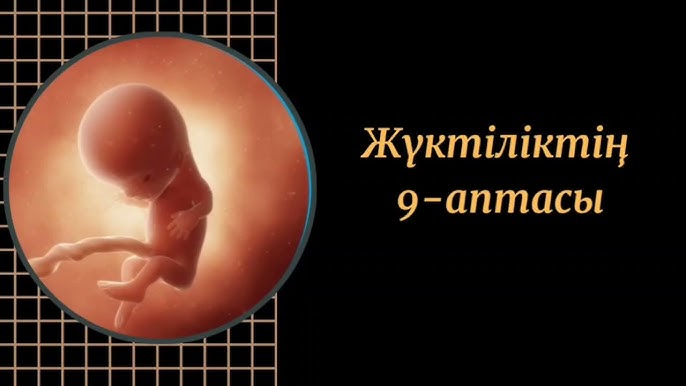 Киевтің жезөкшелері