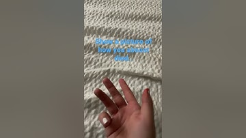 Show a picture of how you almost died: