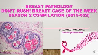 Don't Rush! Breast Case of the Week (Season 2 Compilation - Case #015-022)
