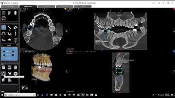 Carestream 3D Imaging Screen Capturing