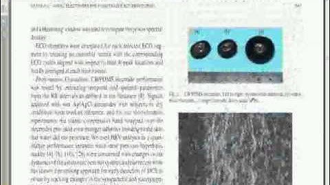 IEEE 2014 SIGNAL PROCESSING MATLAB  NOVEL ELECTRODES FOR UNDERWATER ECG MONITORING
