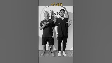 Quadrilateral Lengthening  #limblengthening #gettaller #beforeafter #shorts #livelifetaller