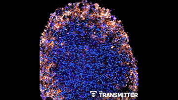 What is the future of organoid and assembloid regulation?