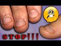 СОЖРАЛА НОГТИ 😬 Преображение ОЧЕНЬ ОБКУСАННЫХ ногтей. НАРАЩИВАНИЕ НОГТЕЙ. Manicure & Extensions