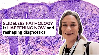 How direct-to-digital technology is transforming tissue imaging | CAP 2024