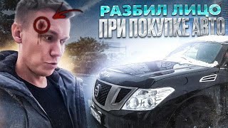 Разбил лицо при покупке авто!👊