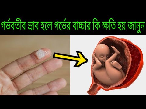 ভিডিও: কী কারণে রঙিন স্রাব হয়?