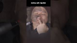 GD토닝 봉원장 실제 시술과정 공개!