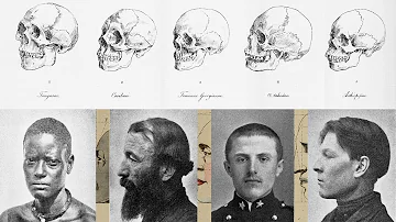 Do humans have unique skulls?