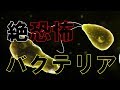 知っ得 致 率95 超え 意識障害 皮膚突き破り 人間の目には見えない 極小の殺人バクテリアwww 雑学倉庫 知っ得 致 率95 超え 意識障害 皮膚突き破り 人間の目には見えない 極小の殺人バクテリアwww 雑学倉庫