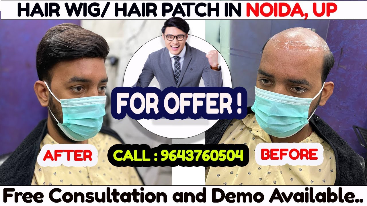 Hair Wig/ Hair Patch in Noida, Up Hair loss treatment Wigs for men Noida Wig shop Noida