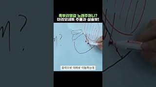 마리오네트 주름 우울해 보이는 인상의 원인 이 주름은 단순한 처짐이 아니라얼굴 구조의 박음질처럼 고정된 선에서 시작됩니다. 설명참고 #마리오네트주름 #주름