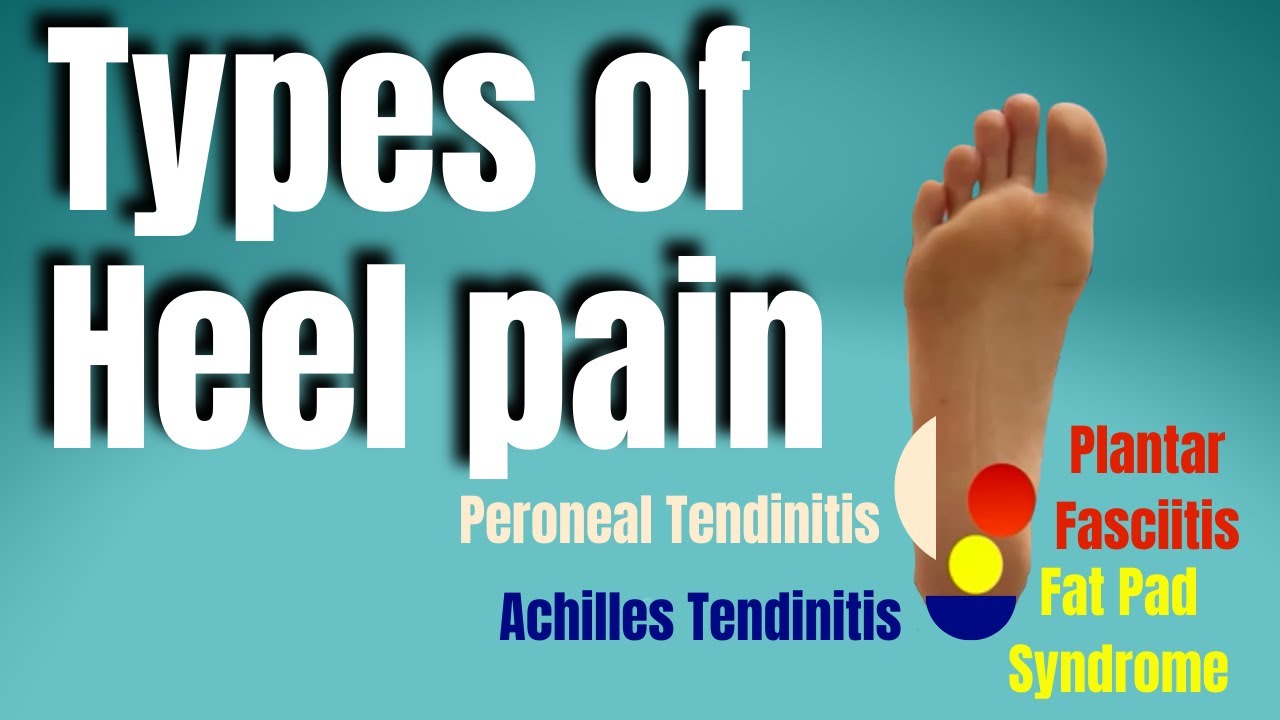 Understanding Different Types of Heel Pain - Dallas TX | Dallas Podiatry  Works