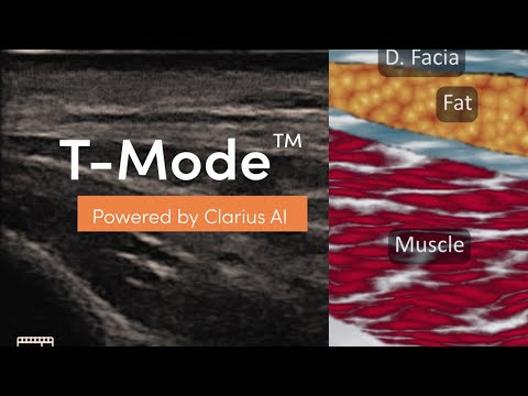 T-Mode™ AI breaks the barrier to learning to recognize grayscale images by instantly providing a duplicate image with vivid displays of anatomical layers that are easily recognizable. Users can learn quickly by matching grayscale images with the images produced by T-Mode.