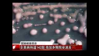 [超級細菌超可怕] 洛城18台晚間新聞05072015