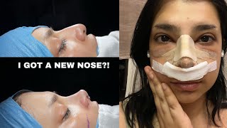 GETTING A NEW NOSE IN TURKEY?! - PART 1 | CLINICHUB & DR SAMIL SAHIN