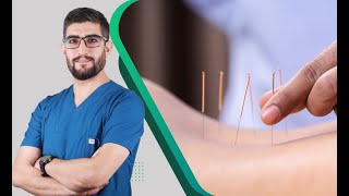 الفرق بين الابر الصينية والابر الجافة - Dry Needling and Acupuncture