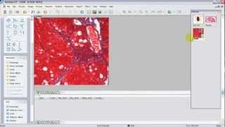 Bio - Percent % Area Analysis (MicroVisual Solution)