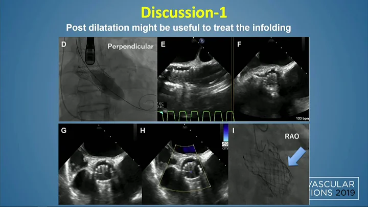 CVI 2019_Friday, 7/19_Structural Challenging Case ...