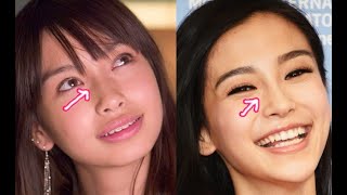 Angelababy Plastic Surgery: The Miraculous Transformation