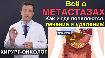 Что такое метастазы рака. Причины появления метастазов - лечение и удаление. Лечение рака и метастаз