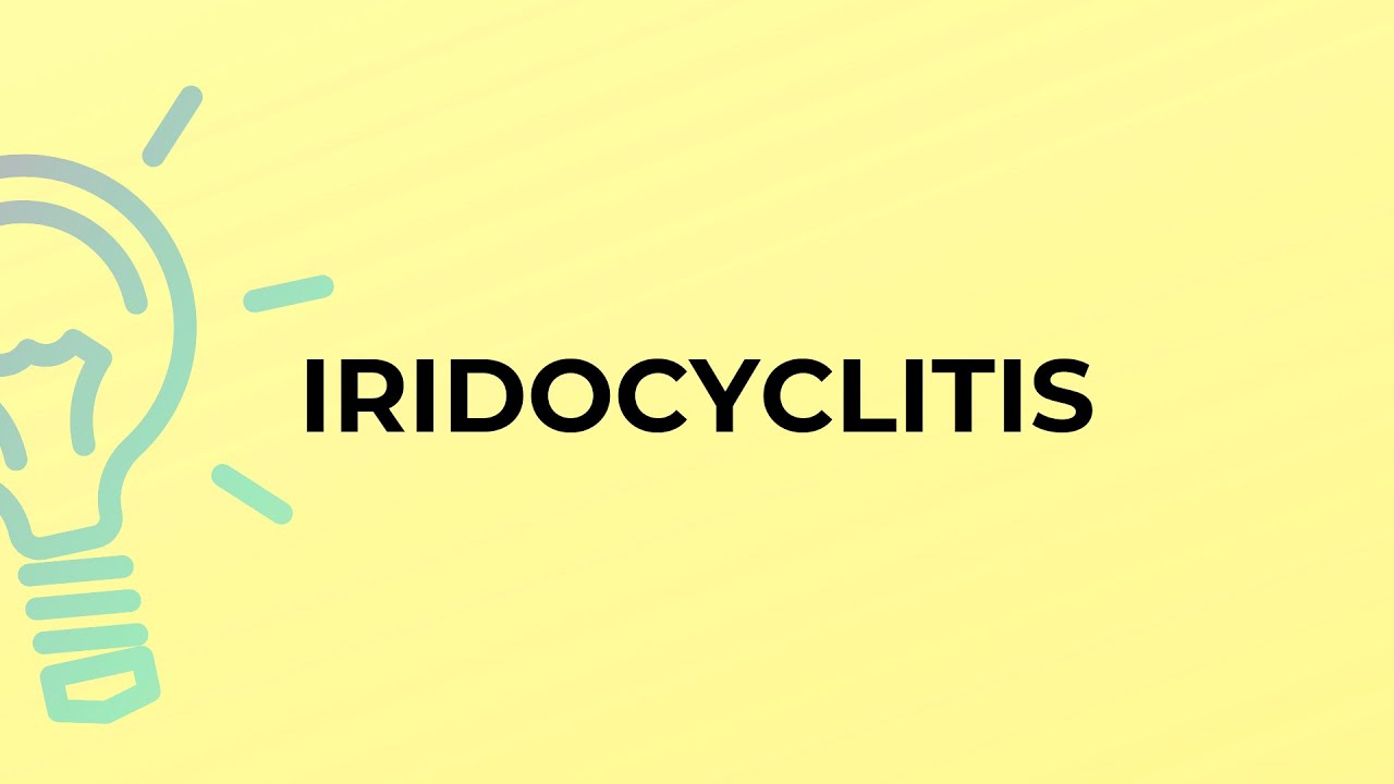 what does irodocyclitis mean